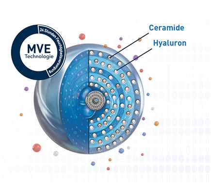 MVE_technologies